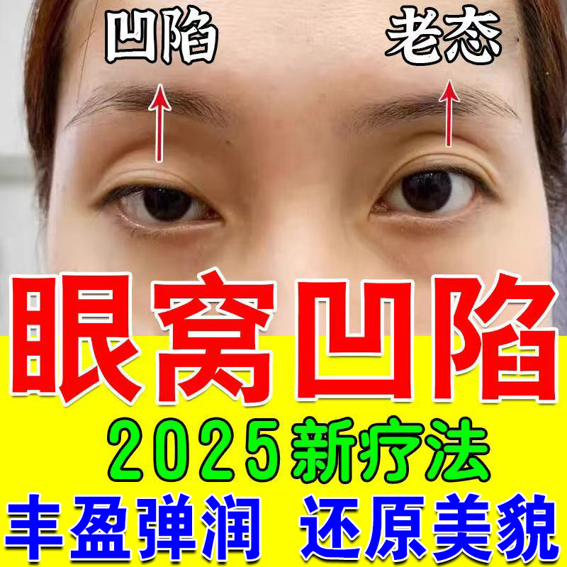 眼窝凹修复去除泪沟改善眼皮松弛陷神器紧致眼周精华油抗皱去细纹