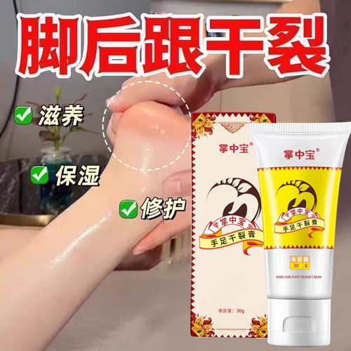 掌中宝手足干裂膏升级款