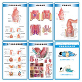 肛肠常见痔疮疾病图例墙贴纸肛肠科解剖图医院挂图广告宣传海报