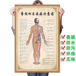 脊柱相关疾病人体脊椎全息图健康速查表美容院装饰画中医挂图广告