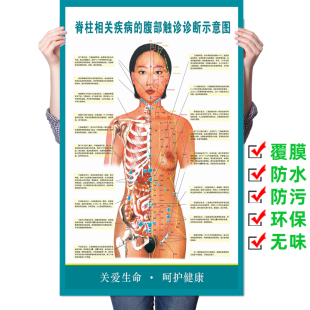 脊柱相关疾病的腹部触诊诊断示意图海报 医院医学人体脊柱挂图