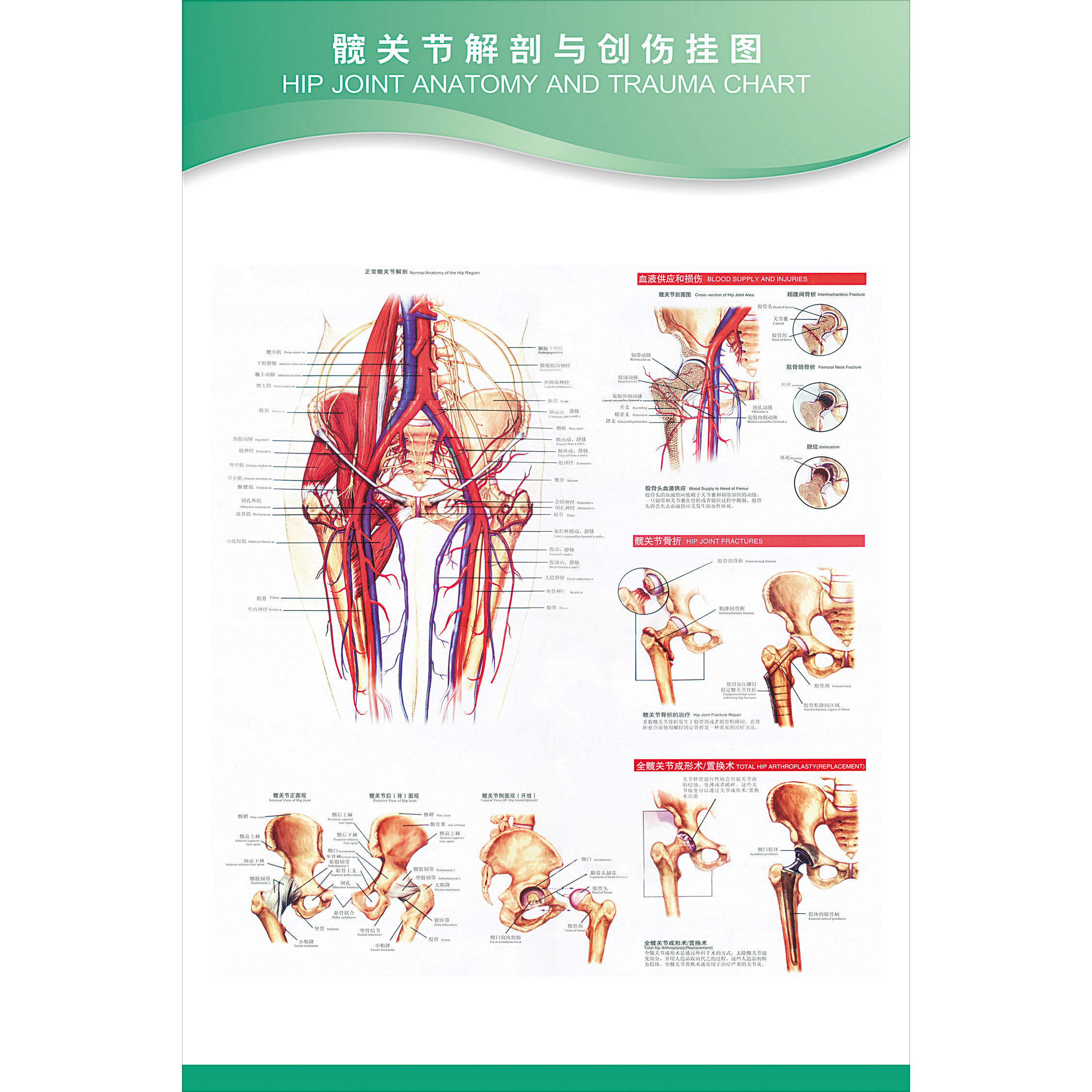医院医学关节解剖挂图《髋关节解剖与创伤挂图》写真图海报 定做