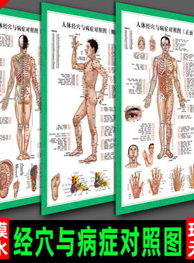 中医养生艾灸穴位图针灸经络全身按摩家用人体经穴与病症对照挂图