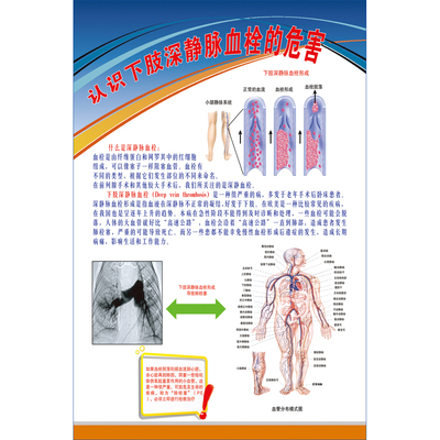 医院心脑血管高血压结构《关于下肢深静脉血栓》疾病危害海报挂图