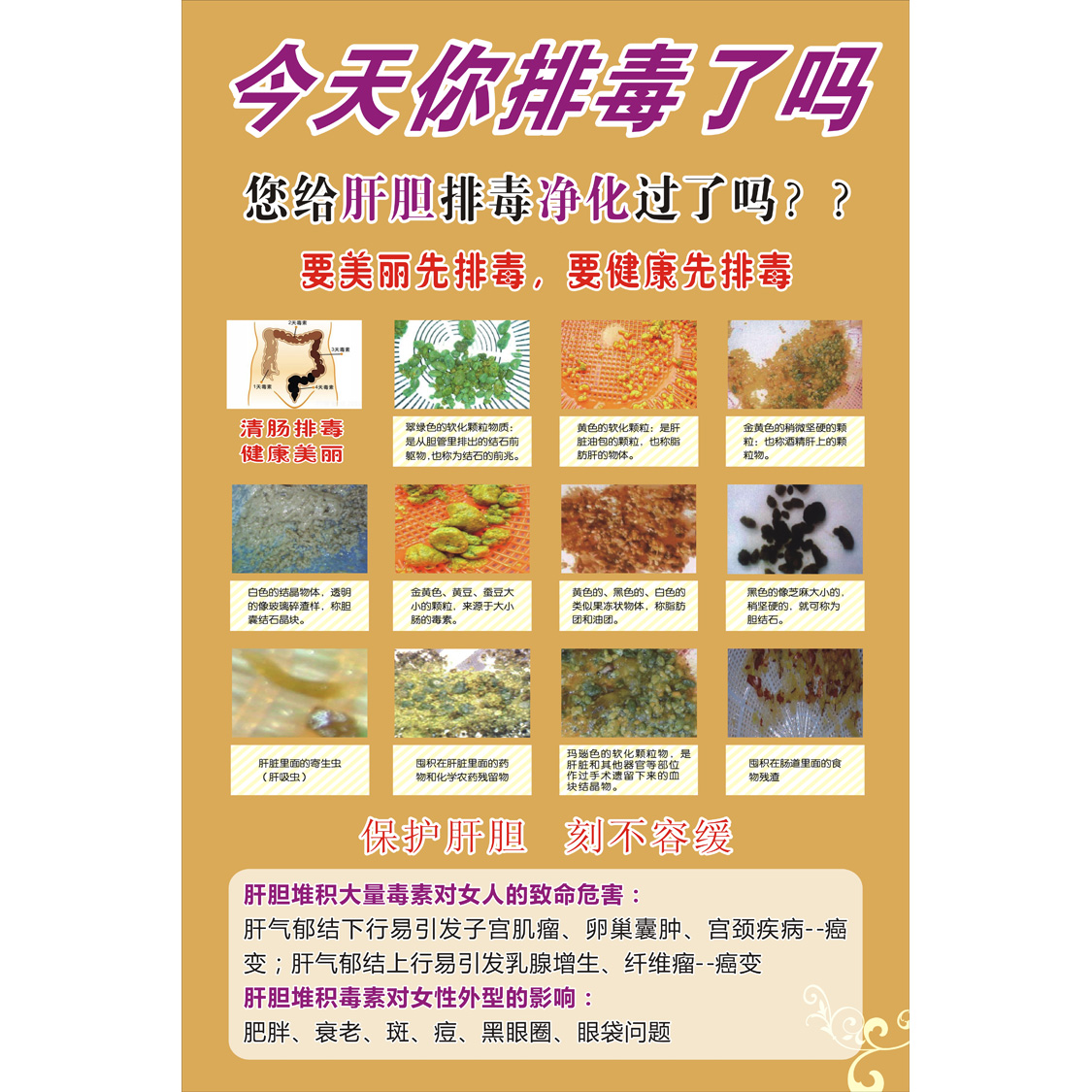 中医养生美容保健淋巴排毒宣传挂图美容肝胆排毒刮痧艾灸按摩海报