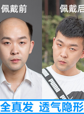 普递假发男全手工递针补发片韩版帅气隐形无痕短发前额无痕真人发