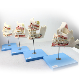 ENOVO颐诺儿童牙列与颌骨发育模型乳牙恒牙幼儿口腔牙齿模型牙齿