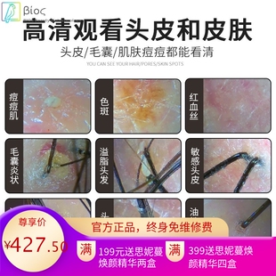 无线头皮毛囊毛发检测仪高清检查仪器连接手机头发皮肤测试仪脸部