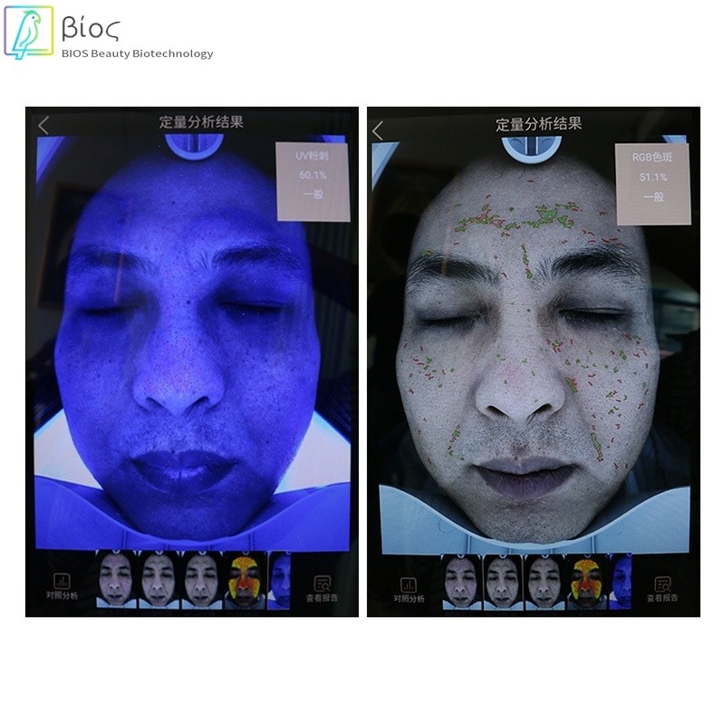 魔镜测试仪3D人脸面部脸部拍照测试美肤分析仪韩国M9皮肤管理仪器