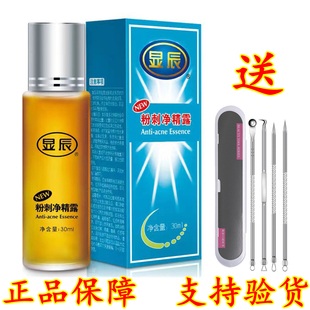显辰粉刺净精露30ml大痘小痘粉刺净痤疮祛痘控油精华露安徽老品牌