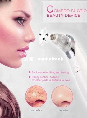 Blackheads Electric Artifacts Acne Home Pore Clean Exfoliati