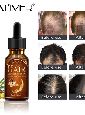Hair Growth Ginger Oil Tonic Toppies Shampoo anti Hair Loss