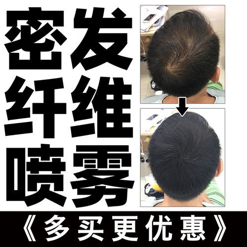 坚野应急效果修饰视觉改善假发