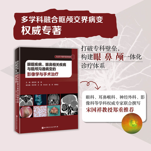 眼眶疾病、眼鼻相关疾病与眶颅沟通病变的影像学与手术治疗 医学 影响 北京科学技术