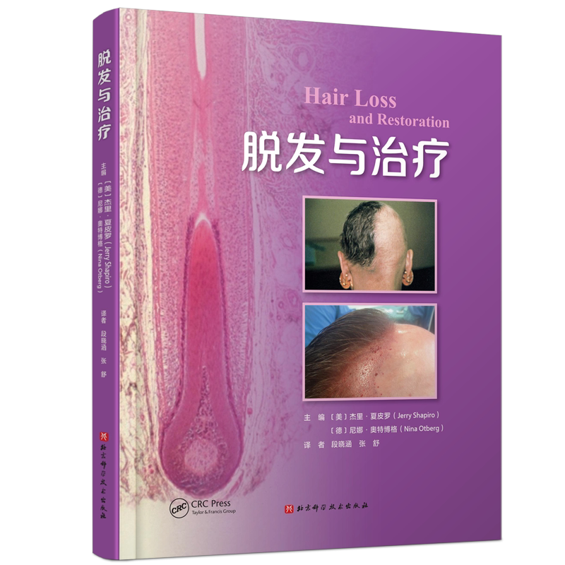 脱发与治疗医学皮肤科