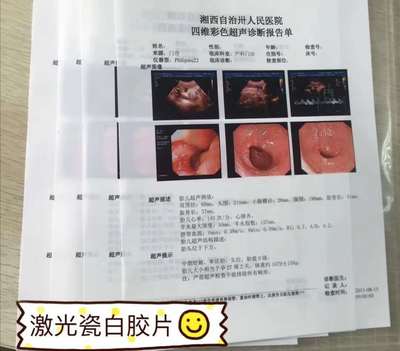 超声胶片、喷墨打印、激光打印、瓷白胶片