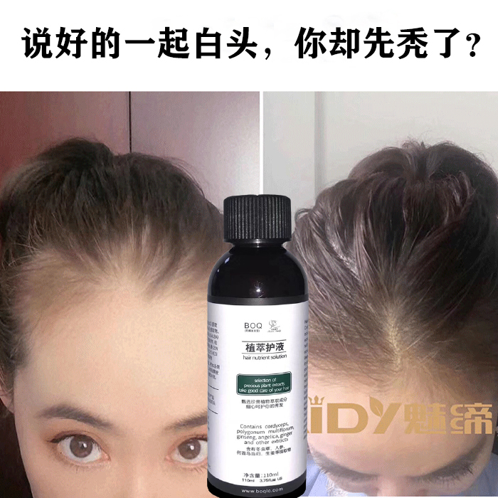 BOQ生发液脱发掉发营养液激活毛囊发际线密发快速头发增长液