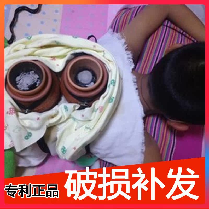 无极玄灸罐儿童脐灸罐