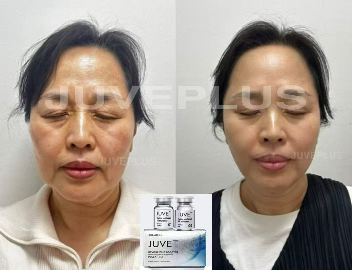 赛罗菲JUVE童颜水光淡化细纹 收紧皮肤