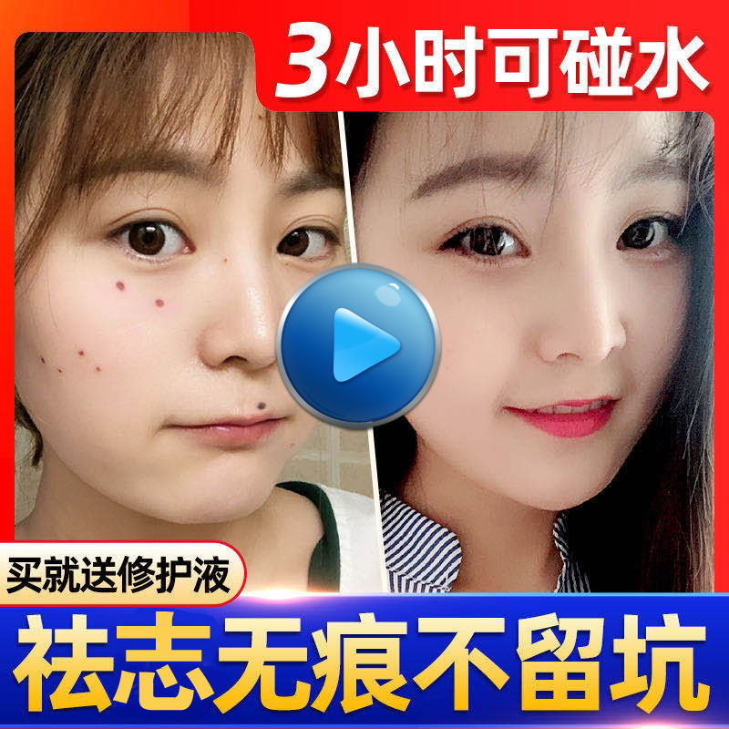 点痣笔去痣药水祛痣膏无痕正品取痣神器美容院专用修复液祛斑脸部