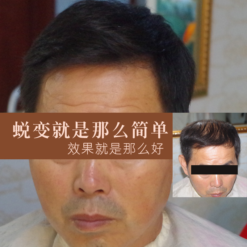 Extension cheveux - Ref 225416 Image 3