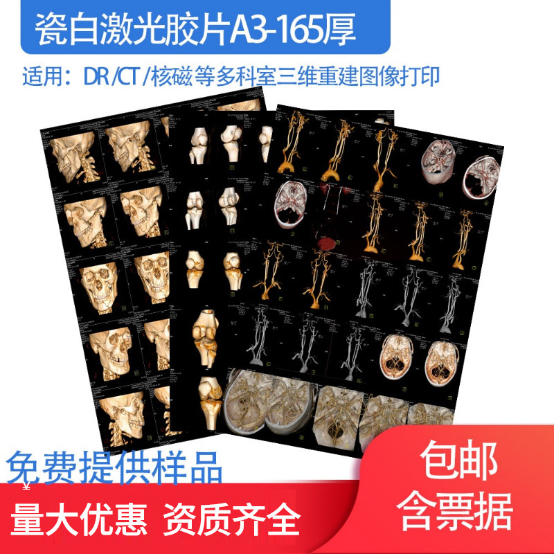 A3瓷白喷墨激光医用胶片13*17放射DR彩色CT三维重建打印14*17卷装