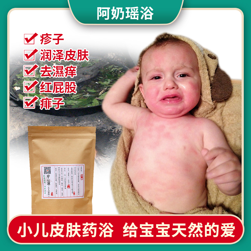小儿益肤婴幼童草本洗澡药浴包