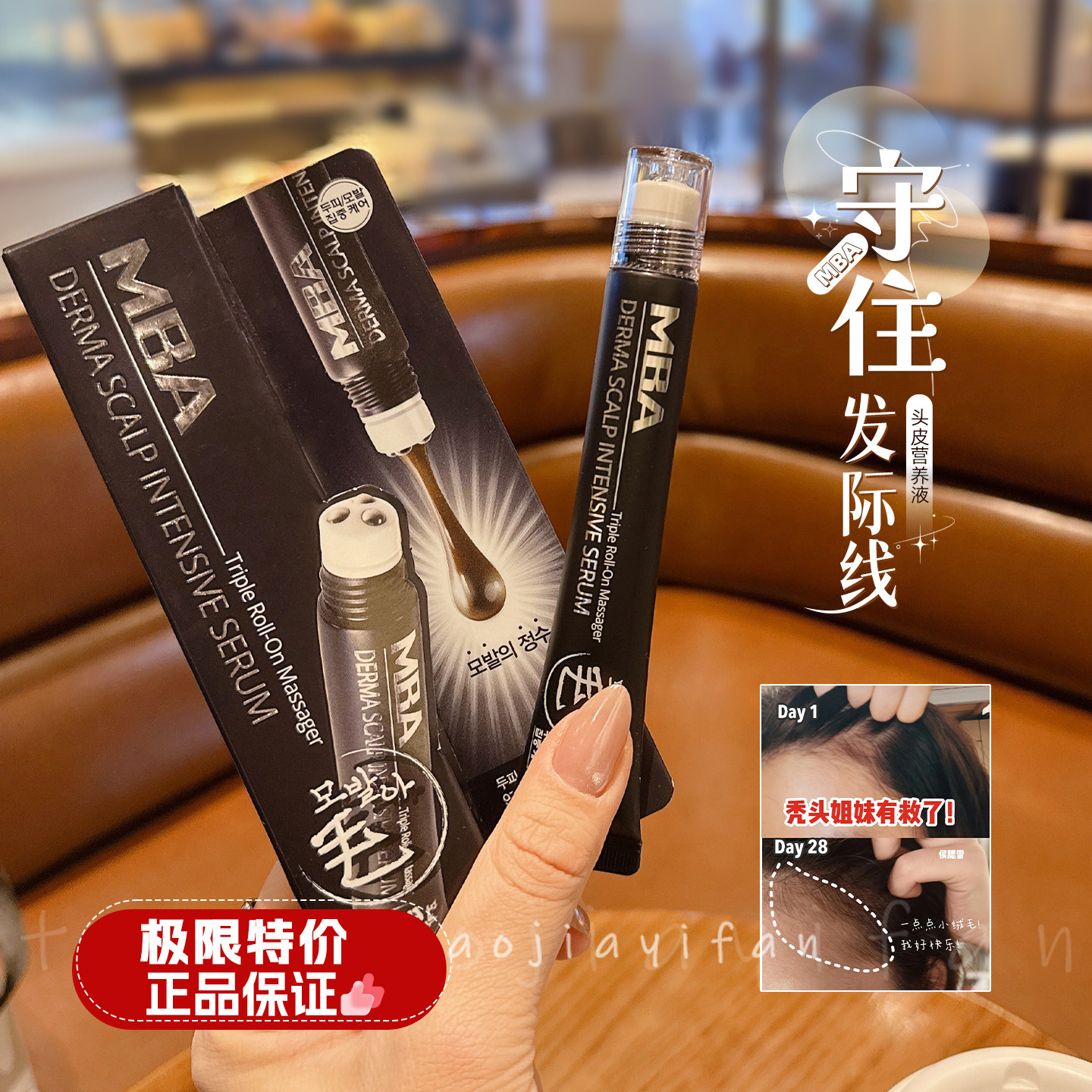 韩国mba头皮营养液滚珠增发增密发际线按摩头皮头发护理,美发护发/假发,头皮精油/精华,淘宝优惠券,粉丝福利购,淘宝优惠卷
