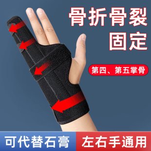 掌骨骨折支具手套保护套支架第四第五手指关节固定器术后夹板
