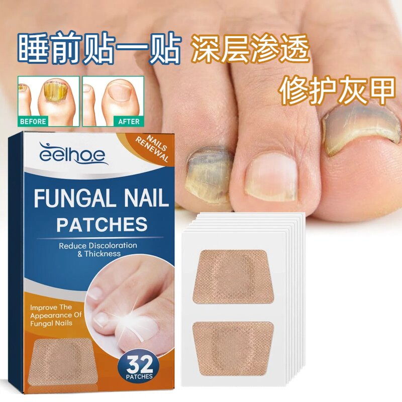 EELHOE 趾甲护理贴 灰指甲护理脚趾甲软甲嵌甲增厚型亮甲沟护理贴