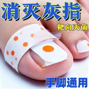 香港专研灰指防护专杀真菌指板足部美甲店灰趾美甲净萃取植物