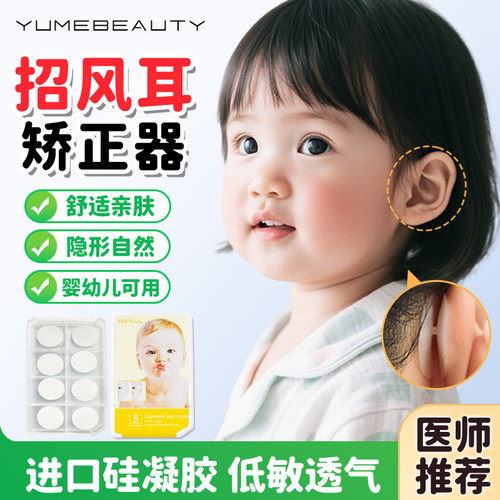 招风耳矫正器—国家专利放心使用