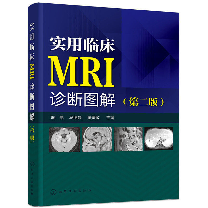 实用临床MRI诊断图解 第2版 临床医学基础知识书 mri诊断与临床读片指南书籍 核磁共振成像诊断学 磁共振成像诊断学 MRI原理与技术