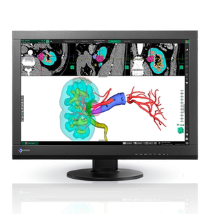 RX370 艺卓EIZO医疗用显示器RadiForce 5MP MX315 GX560乳腺图像