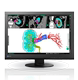 5MP 艺卓EIZO医疗用显示器RadiForce GX560乳腺图像 MX315 RX370