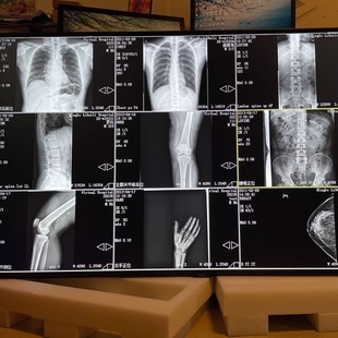 康冠KTC 98寸医疗专用会诊大屏4K高清红外触摸液晶显示器NEC 86寸