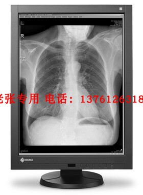 EIZO 艺卓医疗用灰阶显示器5MP GX560 RX370乳腺诊断 RX250 MX317