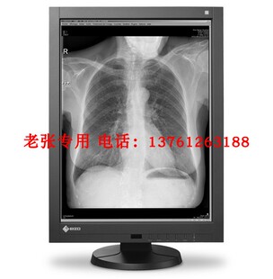 GX560日本原装 艺卓医疗灰阶显示器5MP 康冠乳腺诊断CT检查 EIZO