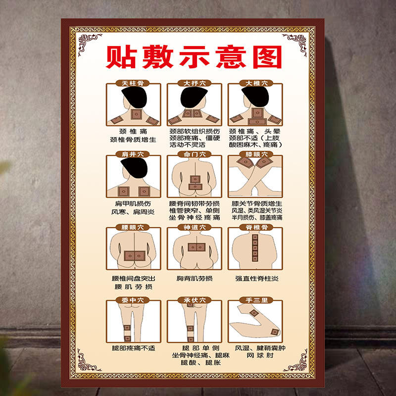 膏药贴敷示意图海报装饰画膏药贴法反应贴纸淤堵kt板调理腰腿疼痛