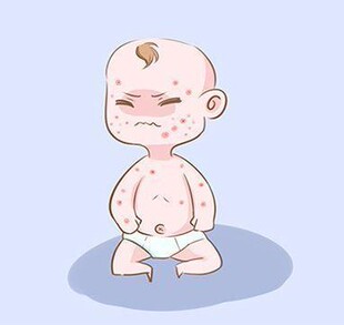 止痒膏外阴湿痒肛门阴囊瘙痒乳膏脱皮水泡脚痒