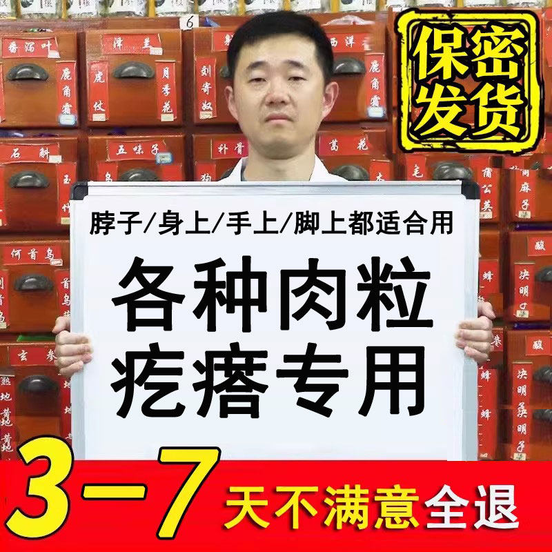 强效祛扁平丝状脖子手上脚底大肉疙瘩肉刺去除膏药一抹灵无忧