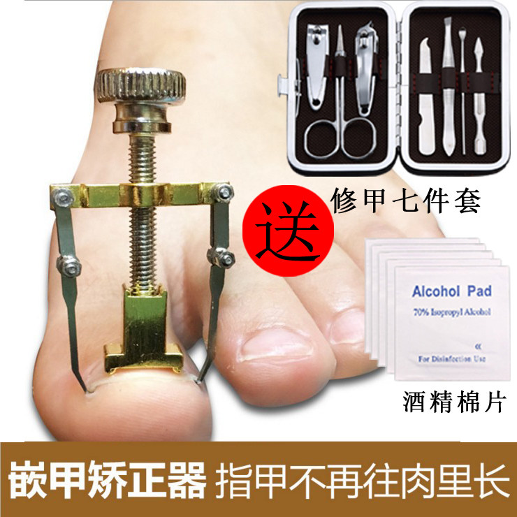 嵌甲矫正器脚趾甲疼修脚工具专用甲沟指甲刀剪钳正甲贴指甲内嵌炎