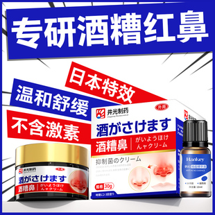 酒糟鼻草莓鼻去红鼻子黑头红肿治收缩毛孔特效专用修复粗大药药膏
