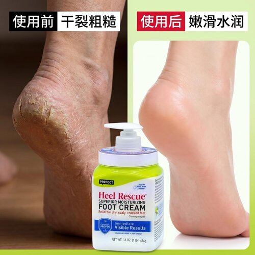 profoot护脚霜滋润保湿防干裂脚