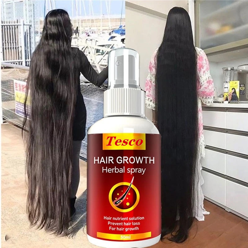 Hair Growth Serum Spray Fast Hair Growth Liquid 头发养护油 美发护发/假发 护发精油 原图主图