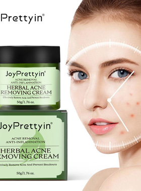 Tea Tree Acne Spot Cream Gently Removes Pimples  Blackheads