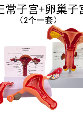 蓝蝶模型子宫卵巢生殖解剖教学