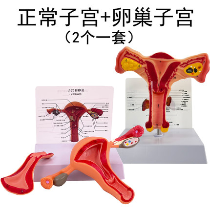 医学女性子宫模型卵巢生殖结构解剖模型妇科妇产科卵巢子宫模型