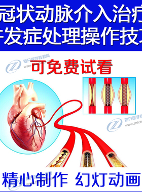 冠状动脉冠脉介入并发症处理操作技巧心血管导丝介入造影教程