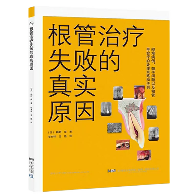 根管治疗失败的真实原因鶴町保著